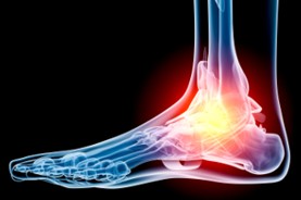 orthotics calgary